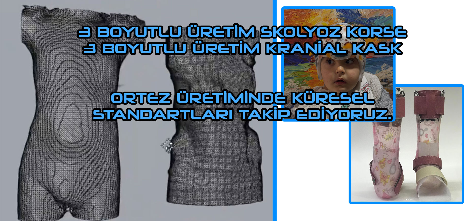 Ortezler